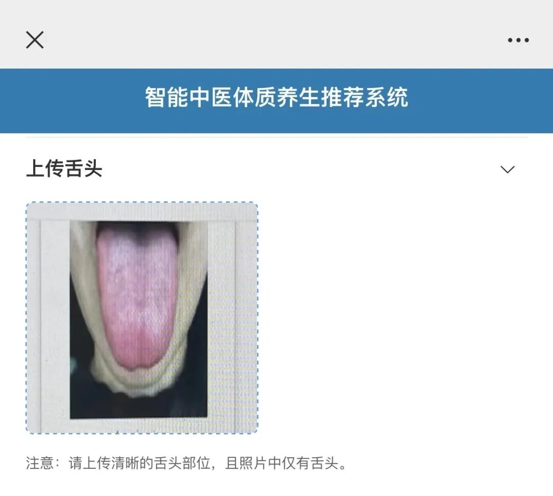 智能中医体质养生推荐系统_舌诊人工智能系统_智能推荐系统