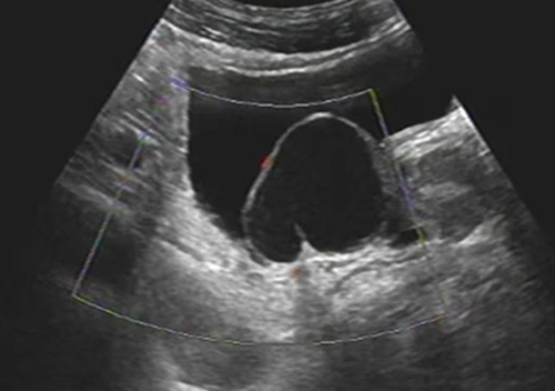 嵌入器官征的启示